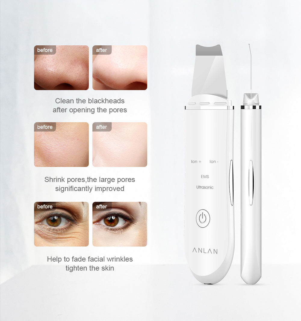 Facial Skin Scrubber